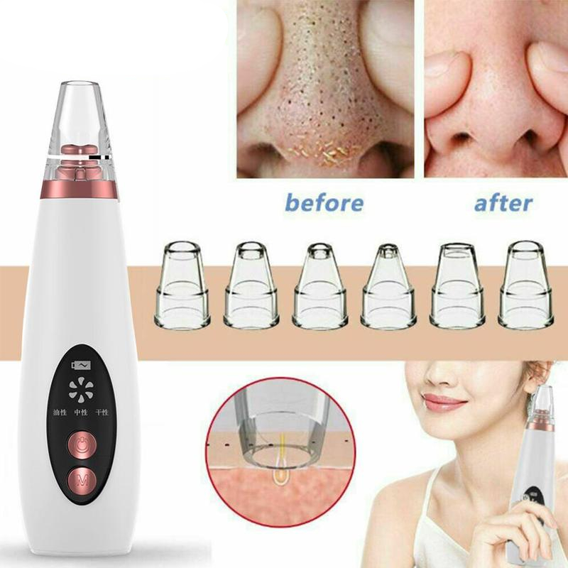 Blackhead Remover Face Pore Vacuum Skin Care Acne Pore Cleaner Pimple Removal Vacuum Suction Facial Tools USB Rechargeable Blackhead Remover Face Pore Vacuum Skin Care Acne Pore Cleaner Pimple Removal Vacuum Suction Facial Tools USB Rechargeable