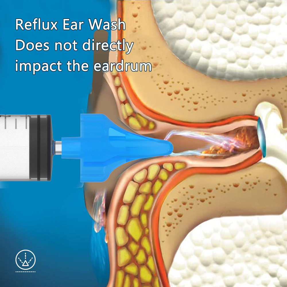 Baby Nasal Aspirator professional şırınge for Baby Nasal Irrigation